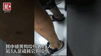 “嘴笼”恒久远,一套永流传!出门前给你家狗子戴上才是真的爱啊!