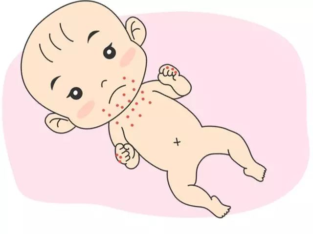 宝宝皮肤出现问题,解决春夏皮肤问题的好方法是什么