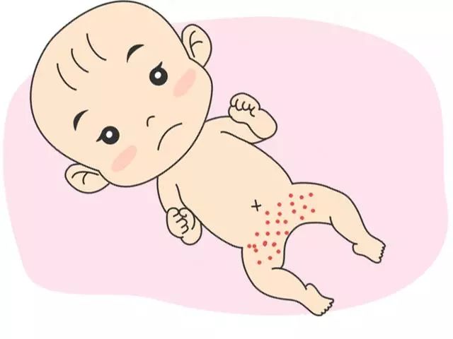 宝宝皮肤出现问题,解决春夏皮肤问题的好方法是什么