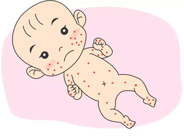 宝宝皮肤出现问题,解决春夏皮肤问题的好方法是什么