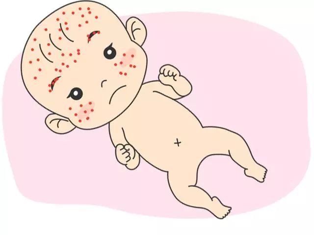 宝宝皮肤出现问题,解决春夏皮肤问题的好方法是什么