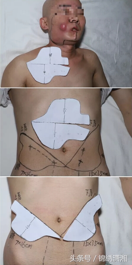 年轻人一定要远离槟榔,槟榔爱好者远离槟榔珍爱生命