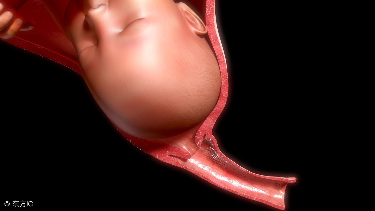 宫颈环扎的孕妈妈们,宫颈机能不全保胎的宝妈