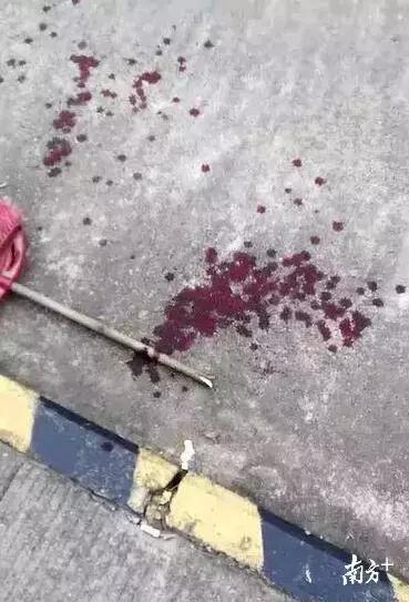 狗咬人被打死狗主人要求赔偿,藏獒先生医疗费谁来付