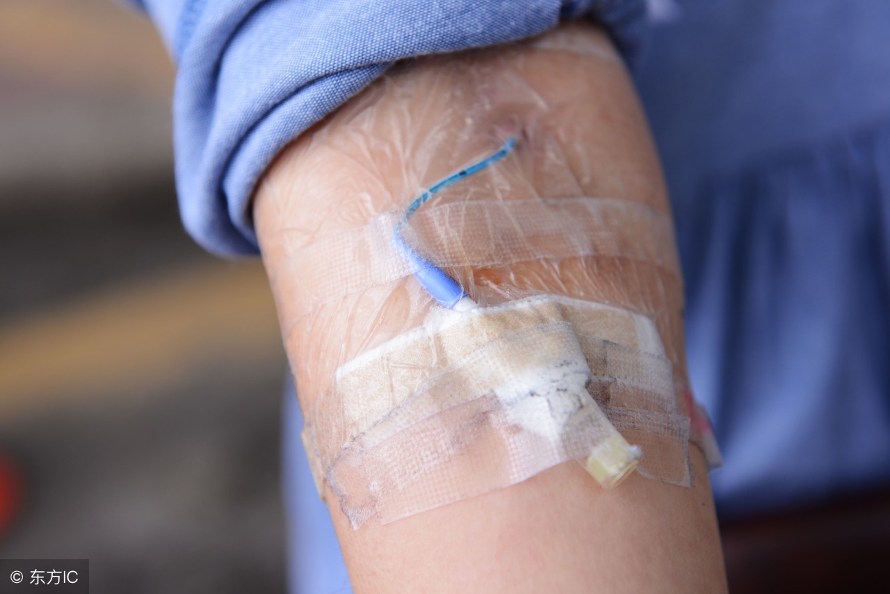 淋巴瘤检查什么最准确,petct检查淋巴瘤