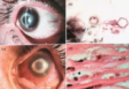 感染食脑虫的人,感染食脑虫的动物