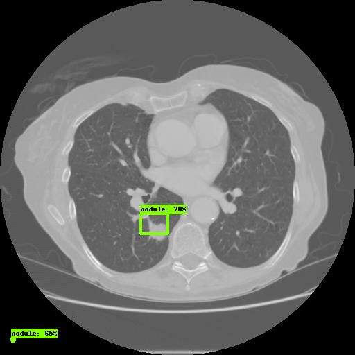 IBM肿瘤医生“沃森”被曝不好用,医疗AI前景堪忧?