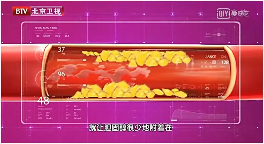 有高血压高血脂吃什么油最合适,高血压高血脂吃什么油最好的