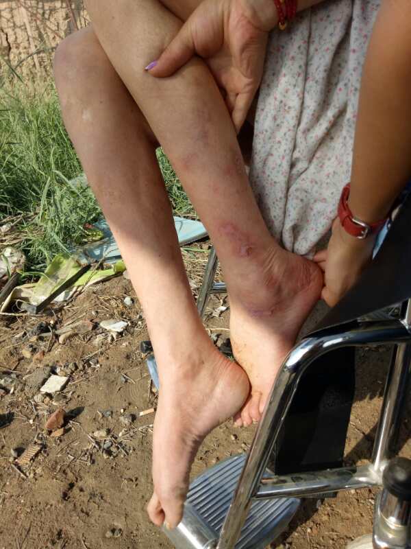 关爱自闭症的孩子视频,关爱智力残疾孩子