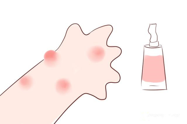 秋后的蚊子咬人特别痒,夏天的蚊子包冬天爆发疹子