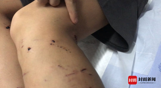 德牧被未牵绳主人暴打,在城市小孩被德牧咬伤怎么赔偿