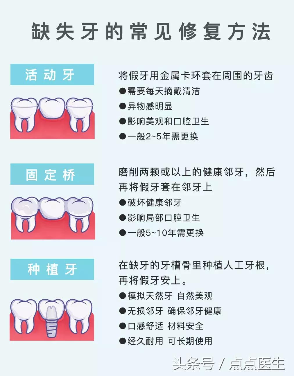 牙齿掉了好几颗补牙的最好方法,牙齿掉了补牙有几种方式