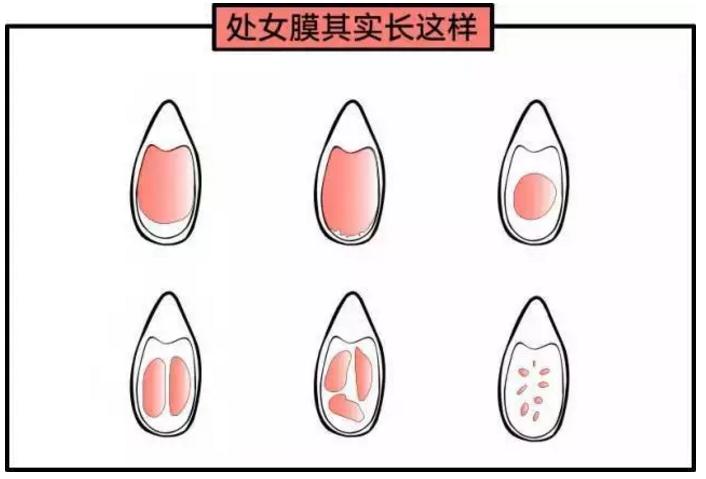 用卫生棉条就不用卫生巾了吗,卫生棉条用了就可以不用卫生巾吗