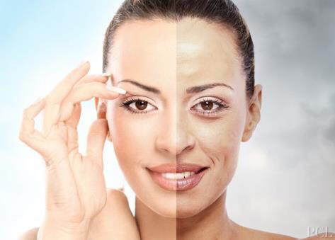 色斑困扰你尝试这些方法改善吧,常见色斑科普及治疗方法