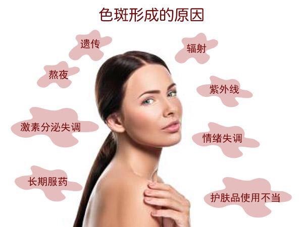色斑困扰你尝试这些方法改善吧,常见色斑科普及治疗方法