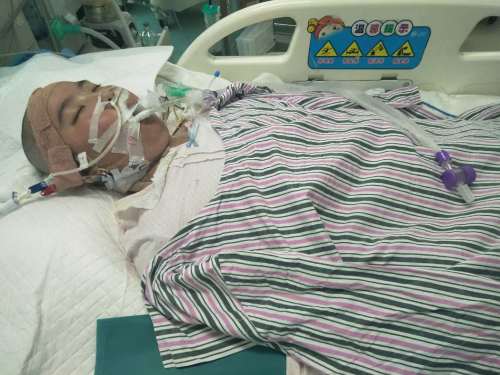 系统性红斑狼疮女孩卖房,14岁女生得红斑狼疮