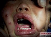 艾滋病知识及传播途径,艾滋病的传播途径和防控方法