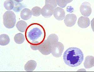 淋巴结肿大8个成因,脖子淋巴结肿大图片