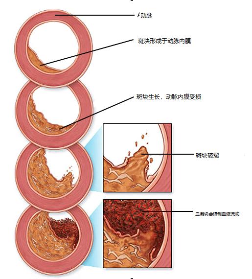关于胆固醇你一定要知道的三件事,关于胆固醇的10个常识