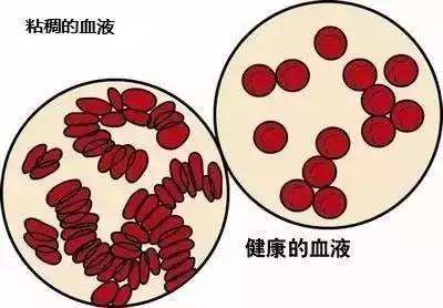 专家讲调理血液方法,血稠医生建议
