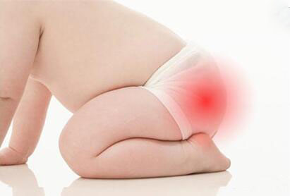 宝宝红屁屁一招搞定,宝宝红屁屁严重性