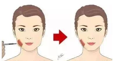 整形医院骗局打假,整形黑幕