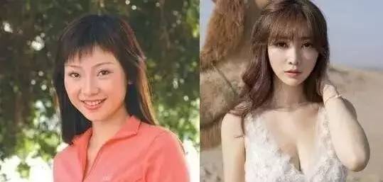 有人劝你打玻尿酸,打玻尿酸的一些常识问题