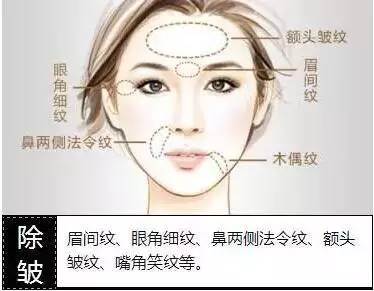 有人劝你打玻尿酸,打玻尿酸的一些常识问题