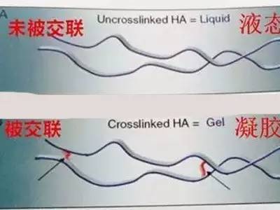 有人劝你打玻尿酸,打玻尿酸的一些常识问题