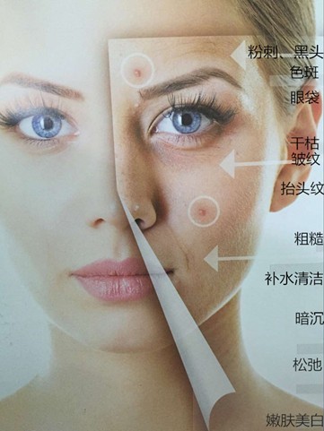 脸部补水仪——你的补水秘密*器武**