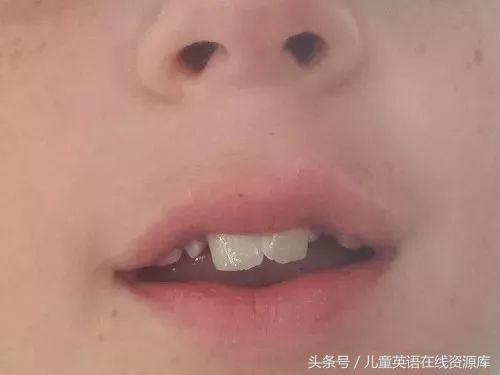 孩子总是反写字母，b和d不分，p和q不分，怎么破？