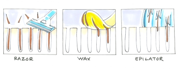 飞利浦脱毛仪br1681与1684区别,飞利浦bri956