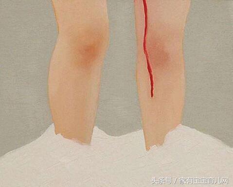 孕期见红会流产吗?有些出血很正常需要注意的是这5种情况!