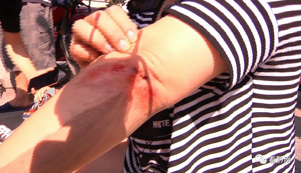 女子高速路口变道致两个人死亡,一名横穿马路女子被皮卡车撞倒