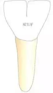 孩子两颗牙长在一起了怎么办,宝宝两颗牙长到一起怎么办