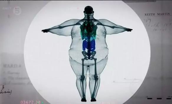 康复治疗膝盖半月板,膝骨关节炎康复运动