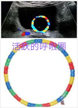 顺产的子宫为什么要流血,顺产后子宫有血怎么办