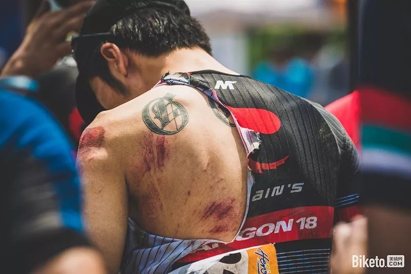 摔车如何快速处理伤口止血,摔车后如何处理伤口