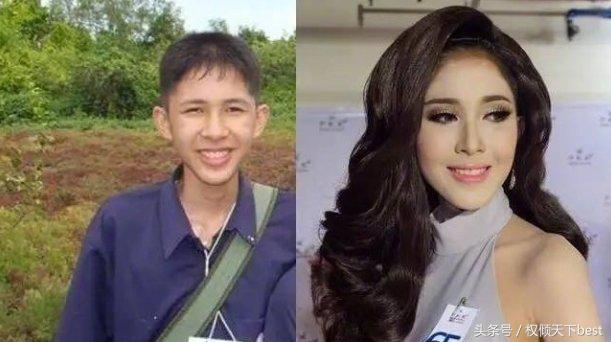 泰国人变性术前后对比,泰国的变性手术是什么原理