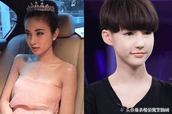泰国人变性术前后对比,泰国的变性手术是什么原理