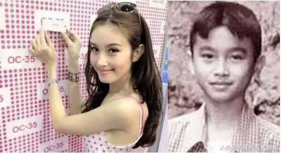 泰国人变性术前后对比,泰国的变性手术是什么原理