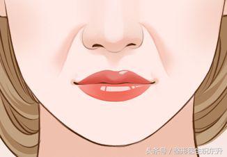 鼻唇沟松弛怎么去除,40岁脸颊凹陷面部下垂怎么解决
