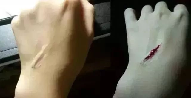 快停手!钻鼻子、撕脸皮、割下巴“抖音易容”*法大**实在太可怕!