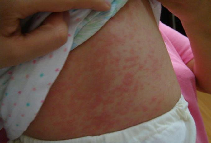 儿童被子螨虫,小孩床垫螨虫怎么消除