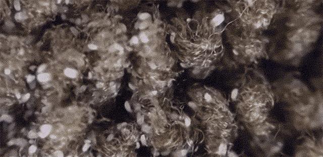 除螨那些事儿,关于除螨的那些事