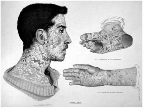 怎样拍好一张患处照片，才能方便网上的医生帮我看病？