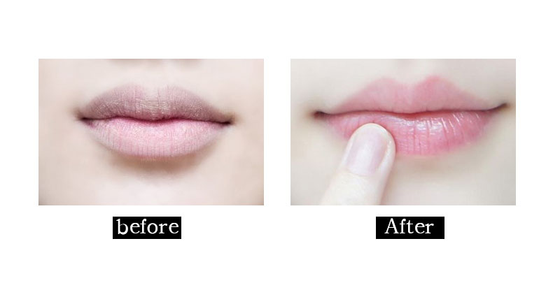 这支异军突起的木瓜膏，它到底有什么好？