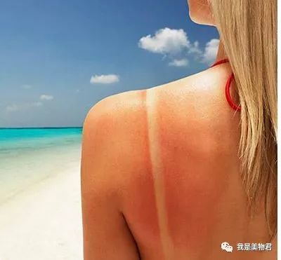 晒黑晒伤用什么药膏,晒伤晒黑修复水乳