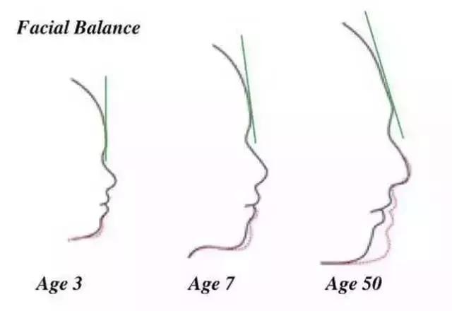 8岁孩子脸越来越长,12岁孩子脸越来越长