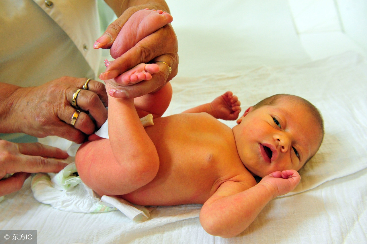 黄疸不黄疸与怀孕时需要注意什么没关系，你只需要记住四个字……